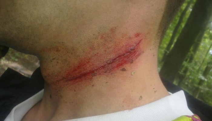 Linka mi�dzy drzewami to usi�owanie zab�jstwa