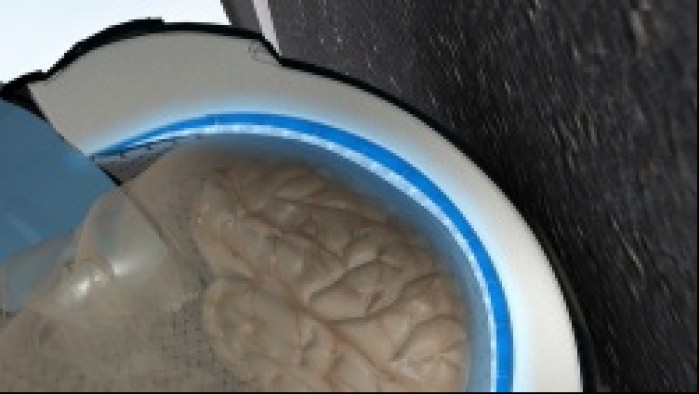 3 ThermaHelm chlodzenie glowy