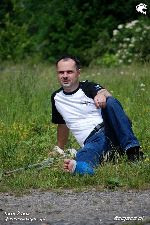 Tomasz Sapela z kotuzja nogi
